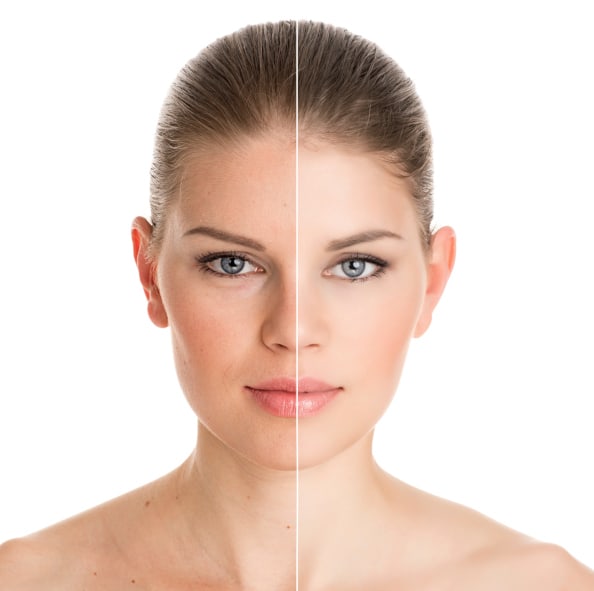 Tegne forsikring baggrund klodset What is Skin Rejuvenation and How Does It Work? | The Dermatology Center Of  Indiana