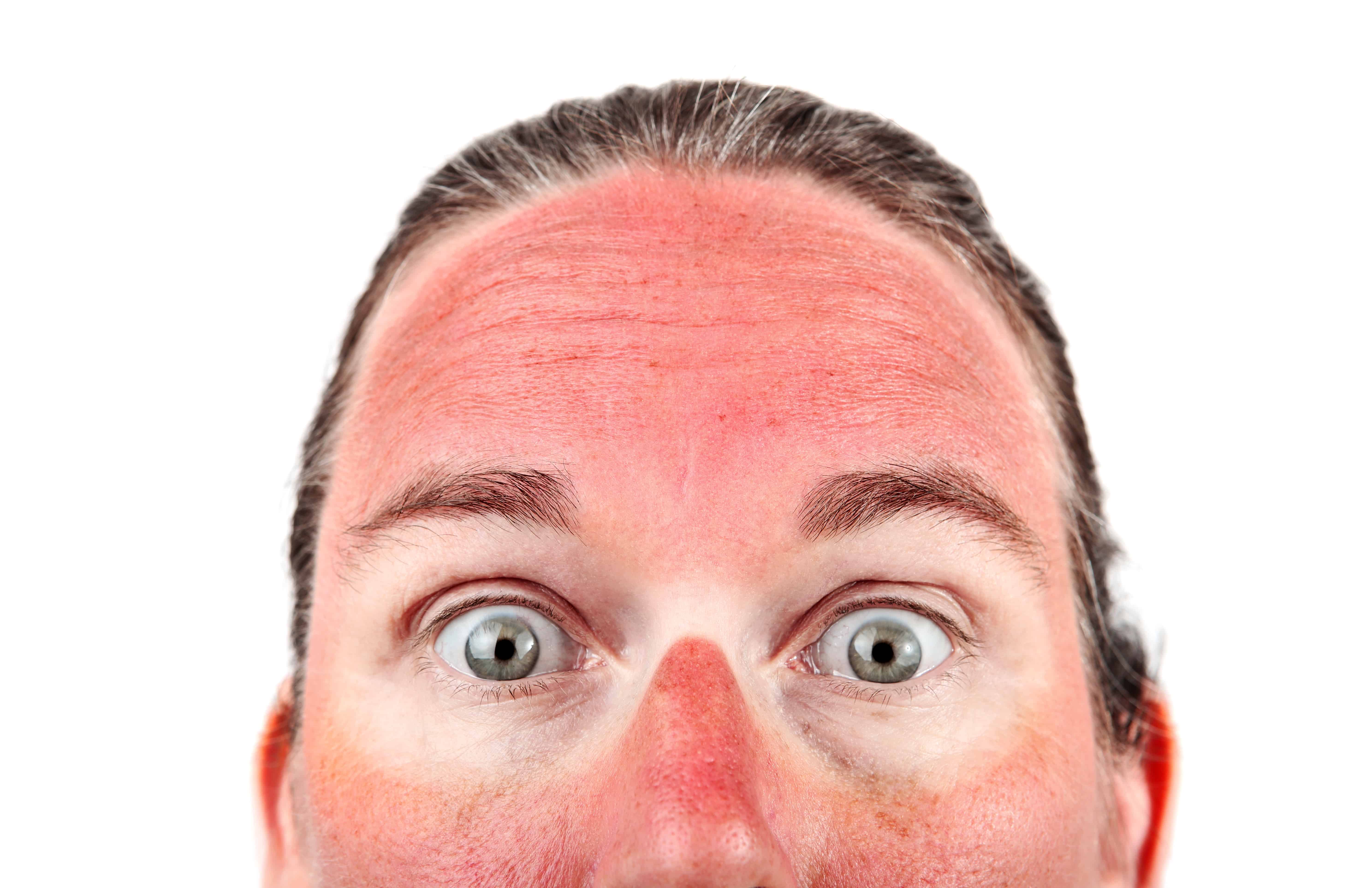 Sun Damaged Skin and Why You Need Checked Immediately