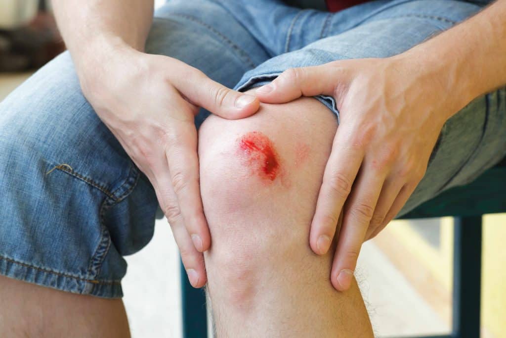 Skin Injury – How do wounds heal?