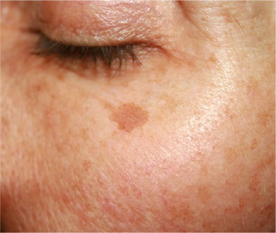 Skin Appearance & Texture