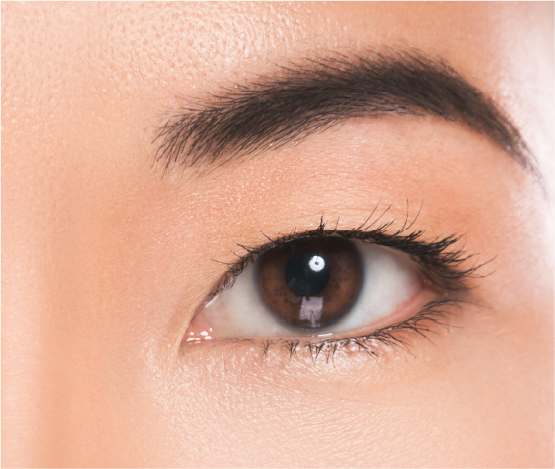 Thinning or Inadequate Lashed
