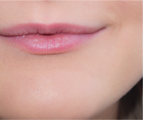 Thin Lips