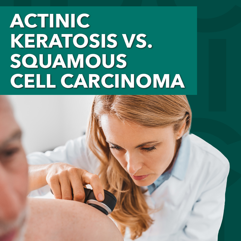 Derm Deep Dive: Types of Skin Lesions 